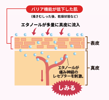 しみる