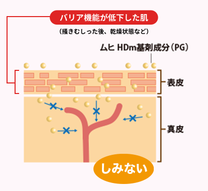 しみない