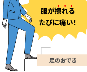 服が擦れるたびに痛い！足のおでき