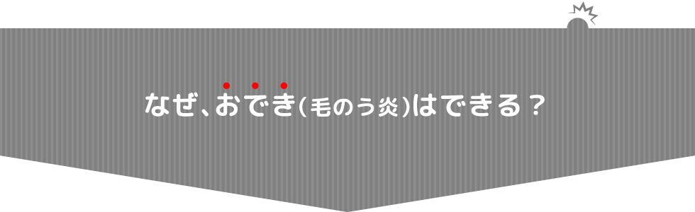 なぜ、おでき（毛のう炎）はできる？