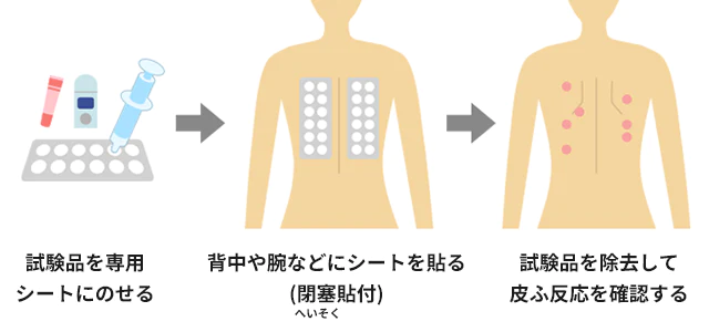 試験品を専用シートにのせる 背中や腕などにシートを貼る（閉塞貼付） 試験品を除去して皮ふ反応を確認する