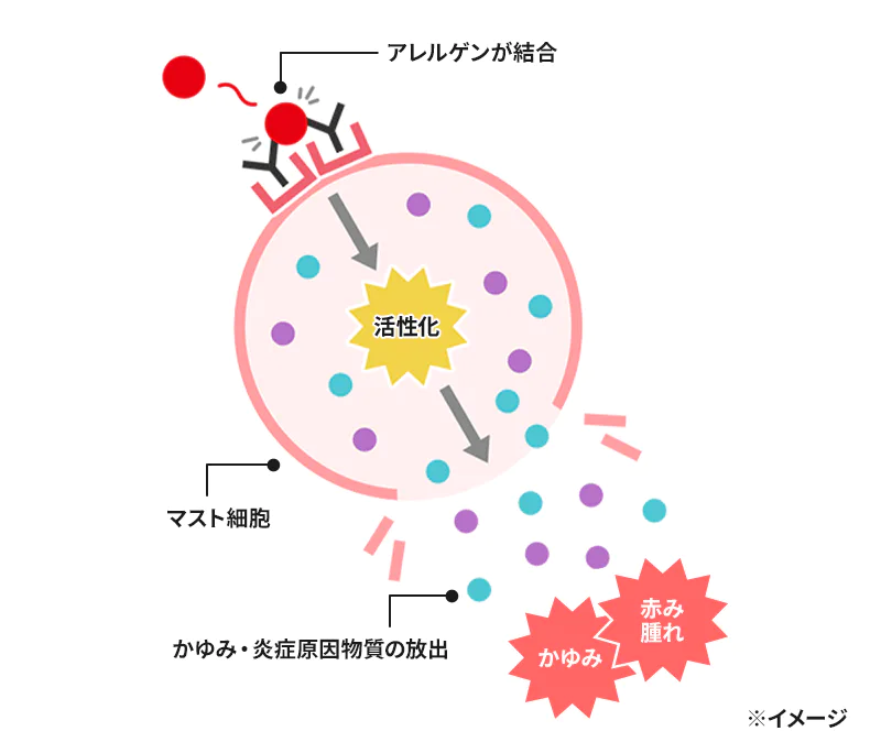 アレルゲンが結合 マスト細胞の活性化 かゆみ・炎症原因物質の放出（かゆみ・赤み 腫れ）